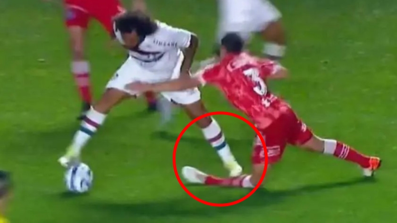 CHOCANTE! Jogador Marcelo quebra perna de argentino em lance acidental