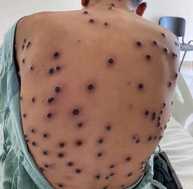 Foto: Reprodução / Desconhecida 